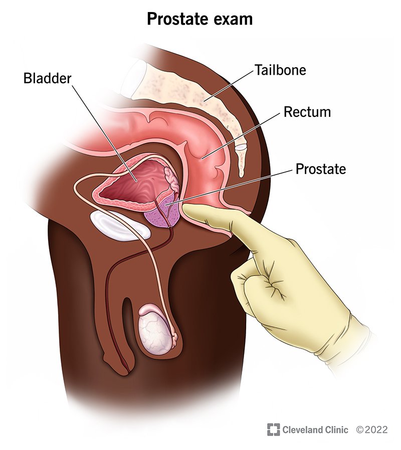 prostate-exam